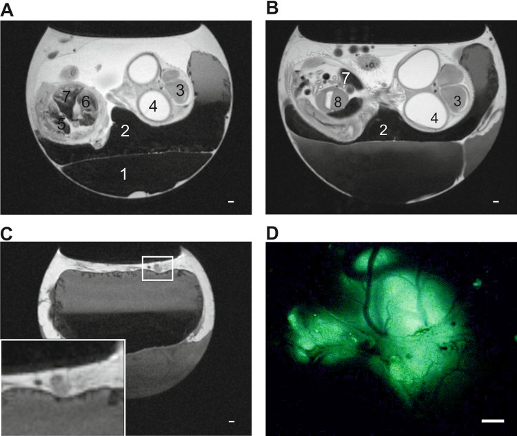 Magnetic Resonance Imaging for Characterization of a Chick Embryo Model of Cancer Cell Metastases.