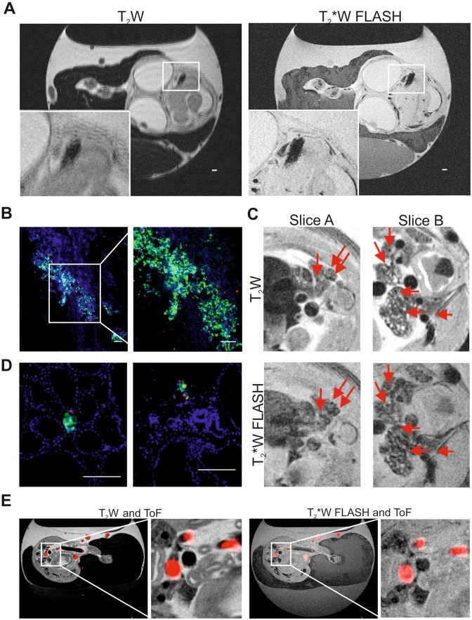 Magnetic Resonance Imaging for Characterization of a Chick Embryo Model of Cancer Cell Metastases.