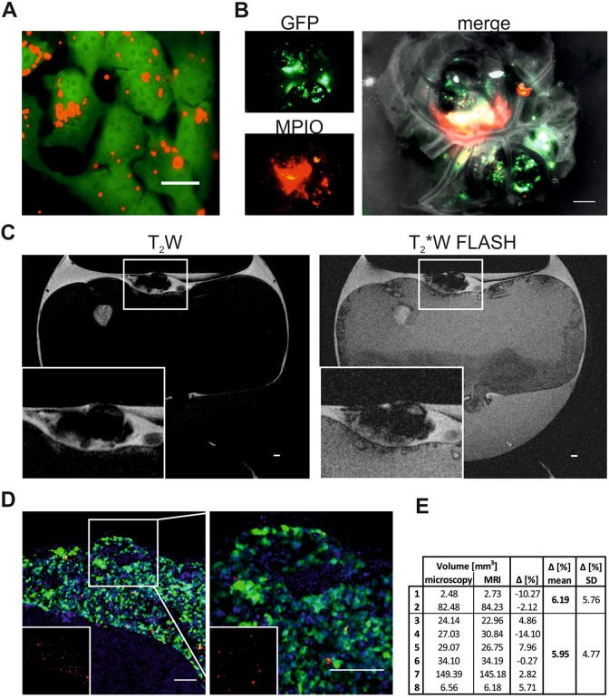 Magnetic Resonance Imaging for Characterization of a Chick Embryo Model of Cancer Cell Metastases.