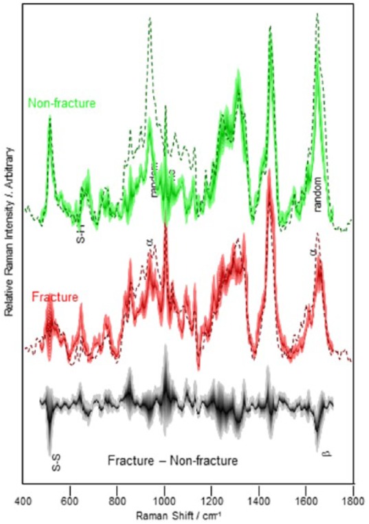 A Preliminary Evaluation of the Ability of Keratotic Tissue to Act as a Prognostic Indicator of Hip Fracture Risk.