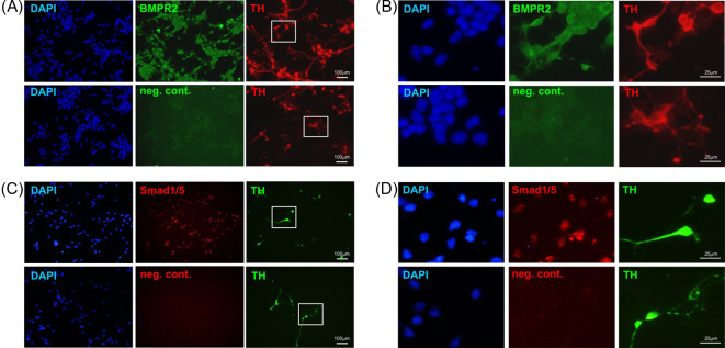 Inhibition of <i>miR-181a</i> promotes midbrain neuronal growth through a Smad1/5-dependent mechanism: implications for Parkinson's disease.