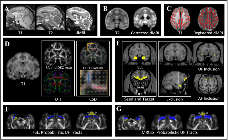 Tract-Specific White Matter Correlates of Age-Related Reward Devaluation Deficits in Macaque Monkeys.