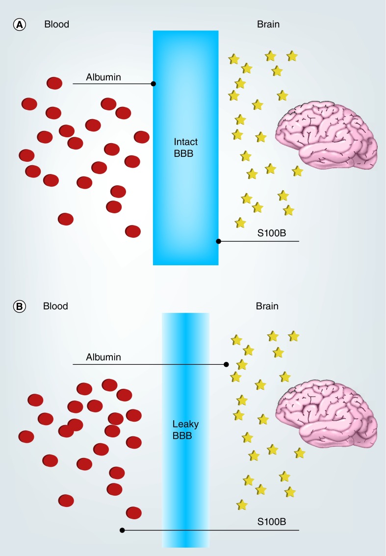 The role and diagnostic significance of cellular barriers after concussive head trauma.