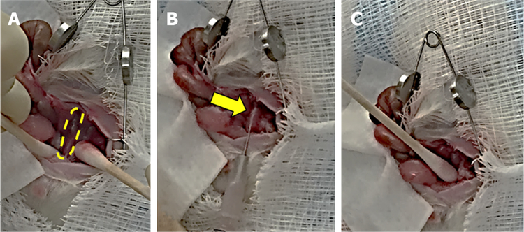Two sides to colon cancer: mice mimic human anatomical region disparity in colon cancer development and progression.
