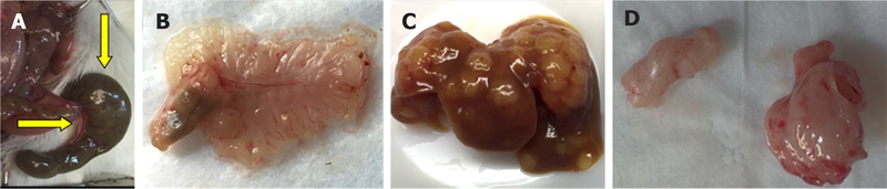 Two sides to colon cancer: mice mimic human anatomical region disparity in colon cancer development and progression.