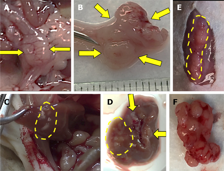 Two sides to colon cancer: mice mimic human anatomical region disparity in colon cancer development and progression.