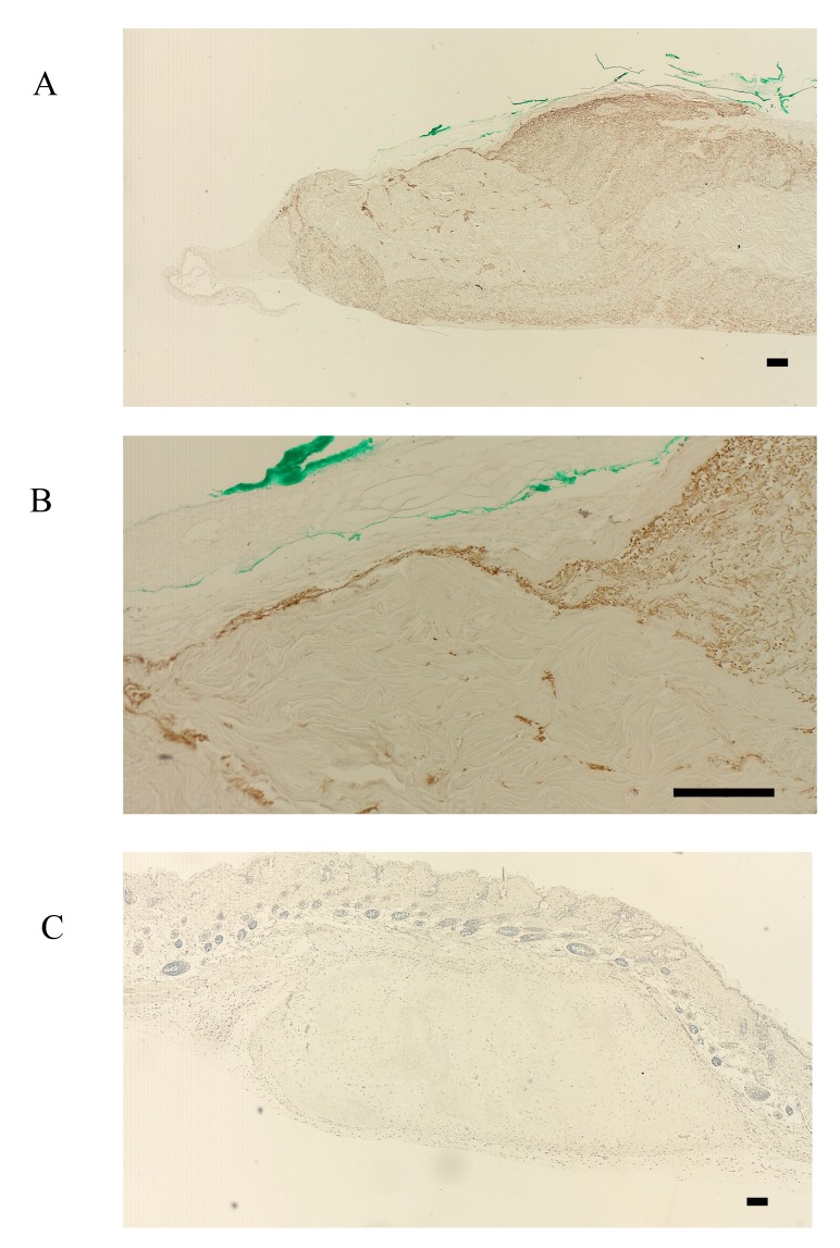 Characterization of the F-box Proteins FBXW2 and FBXL14 in the Initiation of Bone Regeneration in Transplants given to Nude Mice.