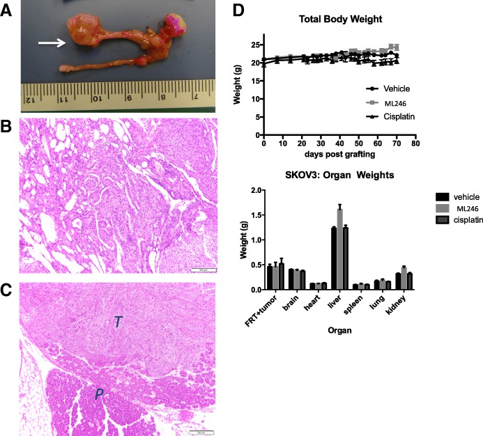 A small molecule inhibitor of the perinucleolar compartment, ML246, attenuates growth and spread of ovarian cancer.