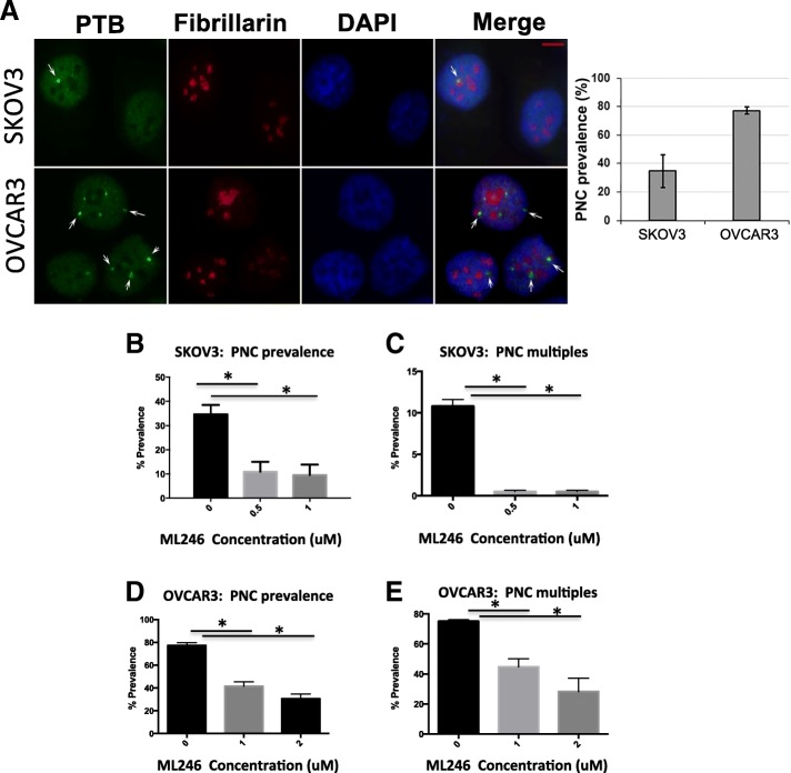 A small molecule inhibitor of the perinucleolar compartment, ML246, attenuates growth and spread of ovarian cancer.