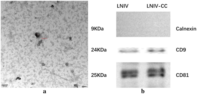 MicroRNA expression profile of urinary exosomes in Type IV lupus nephritis complicated by cellular crescent.