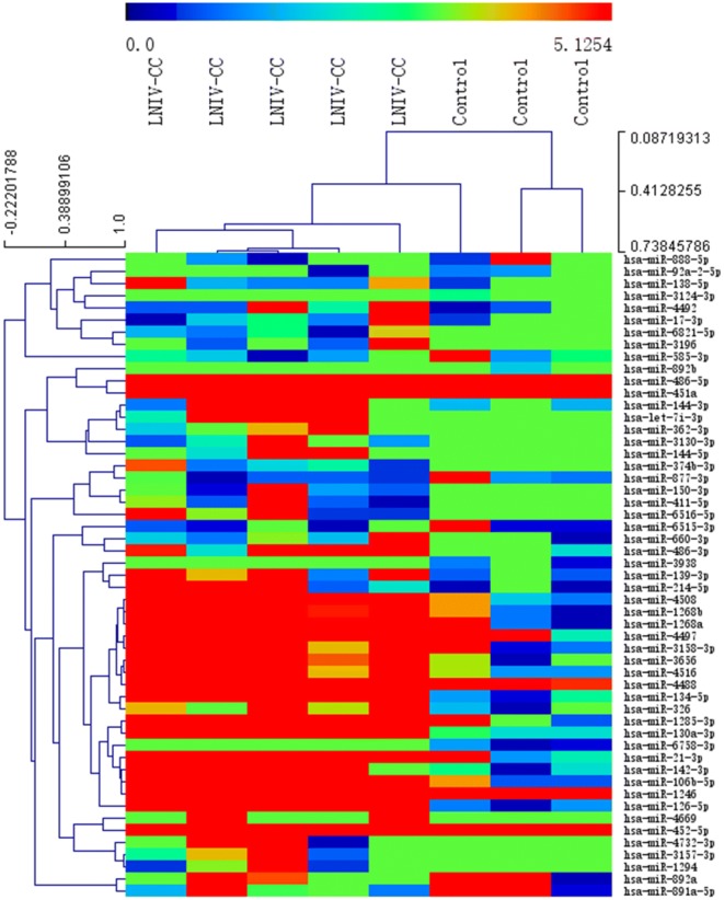 MicroRNA expression profile of urinary exosomes in Type IV lupus nephritis complicated by cellular crescent.