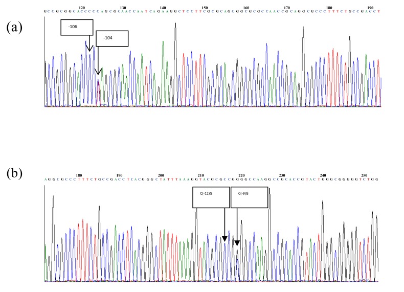 Polymorphisms of Aldose Reductase (ALR2) Regulatory Gene are Risk Factors for Diabetic Retinopathy in Type-2 Diabetes Mellitus Patients in Bali, Indonesia.