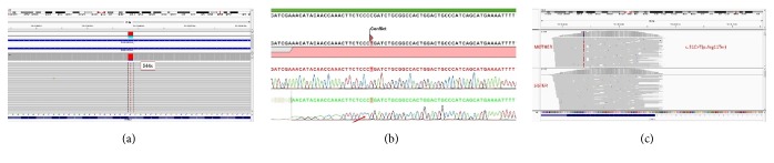 An X-Linked Hyper-IgM Patient Followed Successfully for 23 Years without Hematopoietic Stem Cell Transplantation.