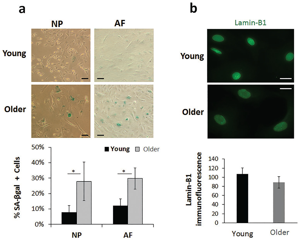 Age-dependent changes in intervertebral disc cell mitochondria and bioenergetics.