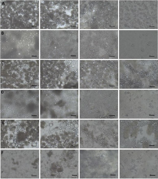 Effects of Fat Reduction on the Stability, Microstructure, Rheological and Color Characteristics of White-Brined Cheese Emulsion with Different Emulsifying Salt Amounts.