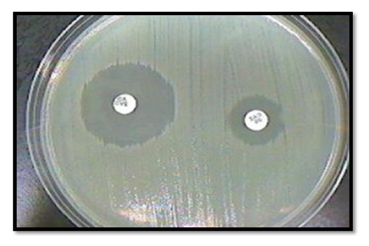 Prevalence of Extended Spectrum Betalactamase (ESBL) and Metallobetalactamase (MBL) Producing <i>Pseudomonas aeruginosa</i> and <i>Acinetobacter baumannii</i> Isolated from Various Clinical Samples.