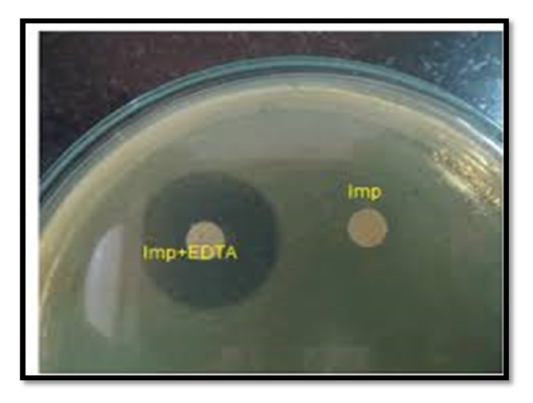 Prevalence of Extended Spectrum Betalactamase (ESBL) and Metallobetalactamase (MBL) Producing <i>Pseudomonas aeruginosa</i> and <i>Acinetobacter baumannii</i> Isolated from Various Clinical Samples.