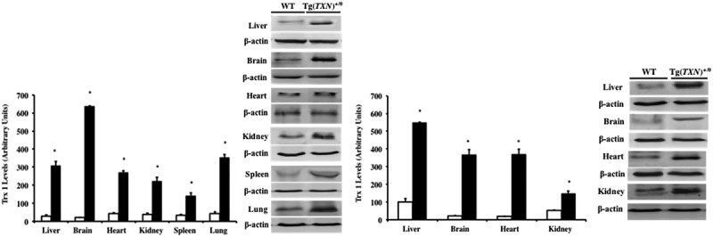 Continuous overexpression of thioredoxin 1 enhances cancer development and does not extend maximum lifespan in male C57BL/6 mice.