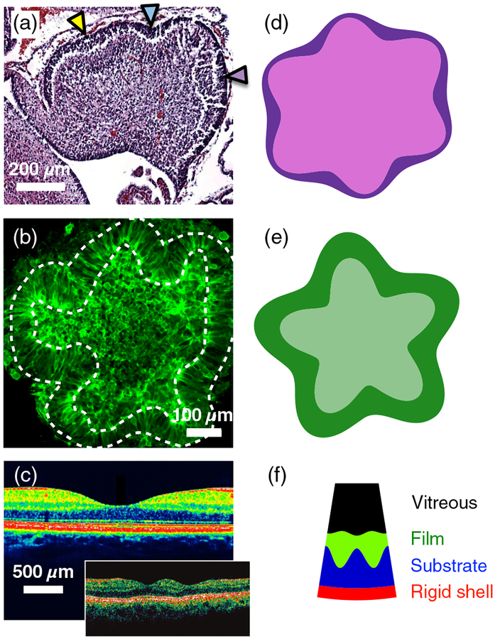 Buckling without Bending: A New Paradigm in Morphogenesis.