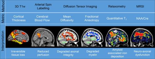 MR approaches in neurodegenerative disorders