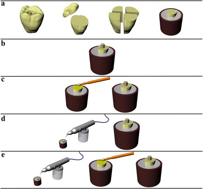 Effect of surface treatments on the bond repair strength of resin composite to different artificial teeth