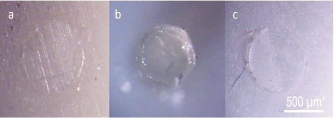 Effect of Storage Time of a Ceramic Primer on Microshear Bond Strength to Zirconia.