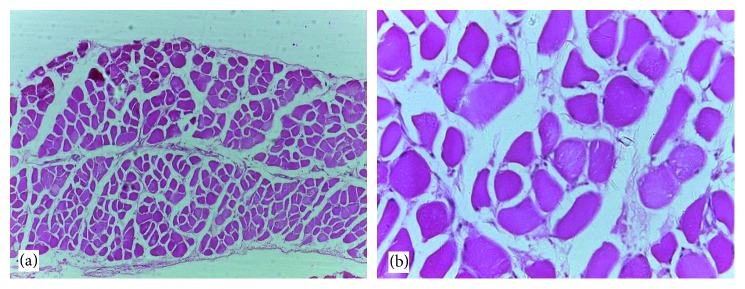 Antidiabetic Effects of the Ethanolic Root Extract of <i>Uvaria chamae</i> P. Beauv (Annonaceae) in Alloxan-Induced Diabetic Rats: A Potential Alternative Treatment for Diabetes Mellitus.