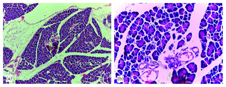 Antidiabetic Effects of the Ethanolic Root Extract of <i>Uvaria chamae</i> P. Beauv (Annonaceae) in Alloxan-Induced Diabetic Rats: A Potential Alternative Treatment for Diabetes Mellitus.