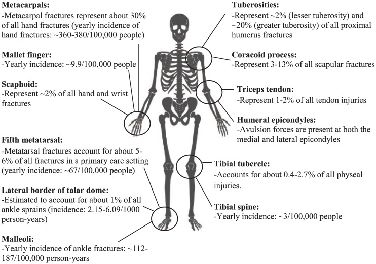 A Narrative Review on Avulsion Fractures of the Upper and Lower Limbs.