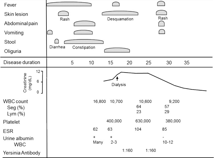 Acute kidney injury and continuous renal replacement therapy in children; what pediatricians need to know.