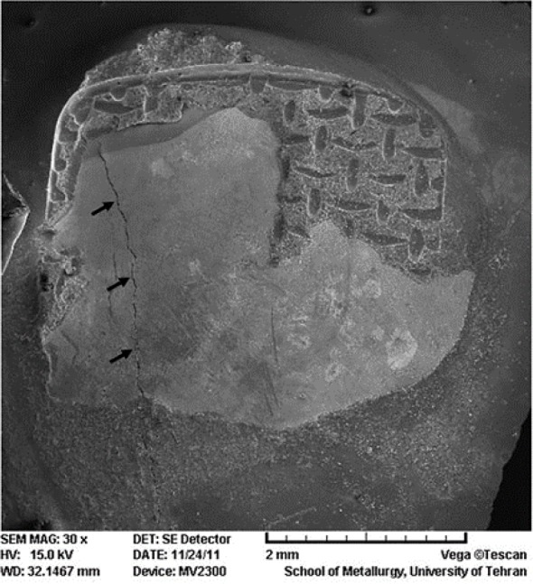 Effect of Cyclic Loading on Shear Bond Strength of Orthodontic Brackets: An In Vitro Study.