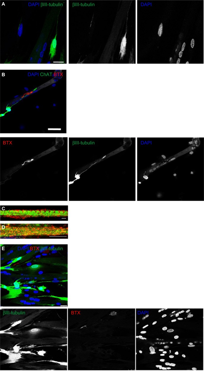 A functional human motor unit platform engineered from human embryonic stem cells and immortalized skeletal myoblasts.