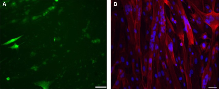 A functional human motor unit platform engineered from human embryonic stem cells and immortalized skeletal myoblasts.