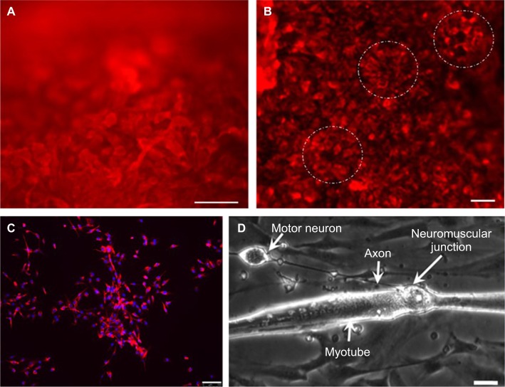 A functional human motor unit platform engineered from human embryonic stem cells and immortalized skeletal myoblasts.