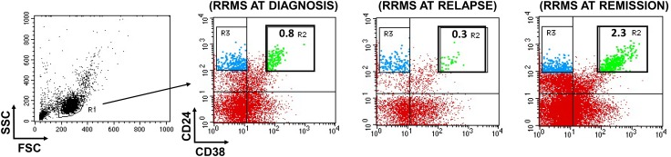 Regulatory B and T lymphocytes in multiple sclerosis: friends or foes?