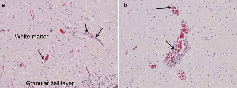 Detection and phylogenetic analysis of parrot bornavirus 4 identified from a Swedish Blue-winged macaw (<i>Primolius maracana</i>) with unusual nonsuppurative myositis.