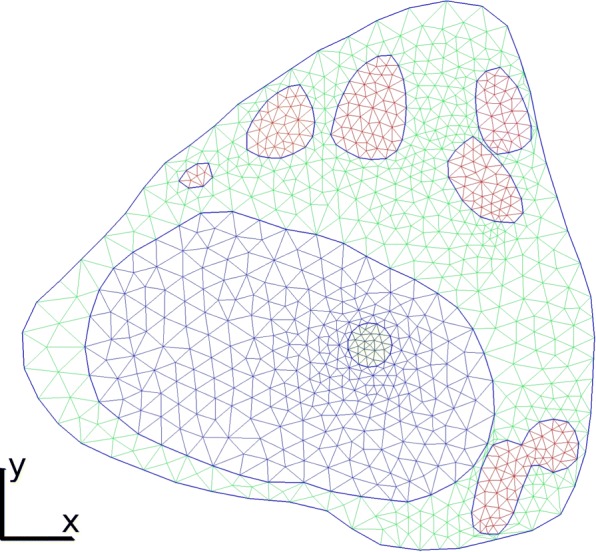 A discontinuous Galerkin model for fluorescence loss in photobleaching of intracellular polyglutamine protein aggregates.