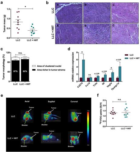 High-intensity interval training slows down tumor progression in mice bearing Lewis lung carcinoma