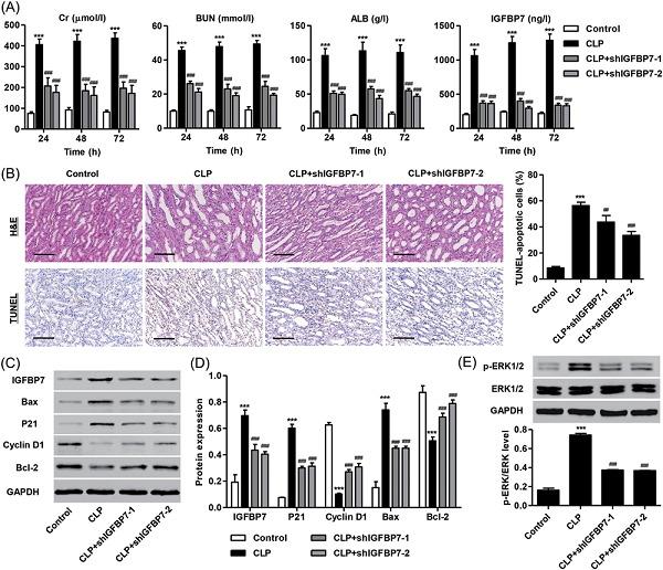 IGFBP7 regulates sepsis-induced acute kidney injury through ERK1/2 signaling