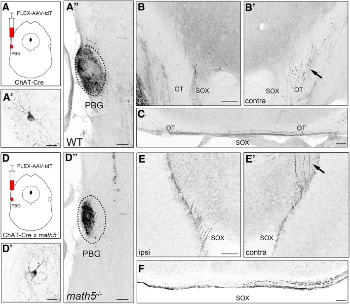 The absence of retinal input disrupts the development of cholinergic brainstem projections in the mouse dorsal lateral geniculate nucleus.