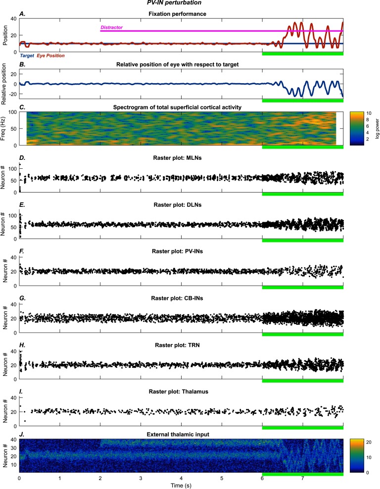 Visual Attention Deficits in Schizophrenia Can Arise From Inhibitory Dysfunction in Thalamus or Cortex.