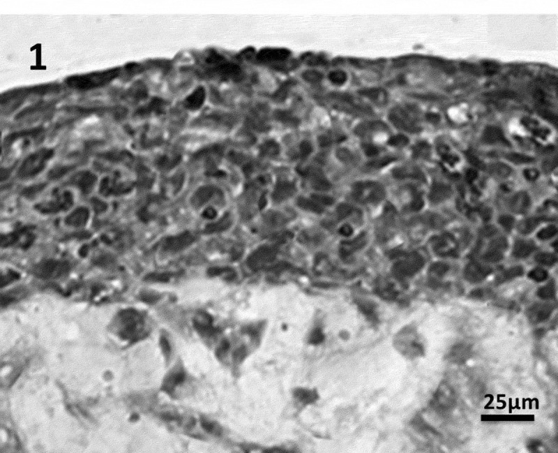 An approach to revolutionize cataract treatment by enhancing drug probing through intraocular cell line.