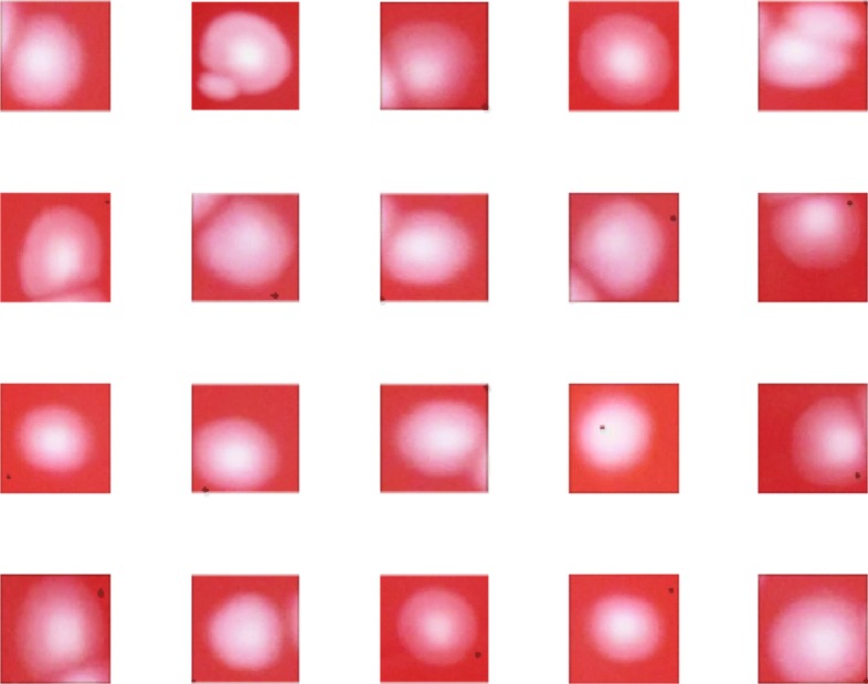 Novel neural network application for bacterial colony classification.