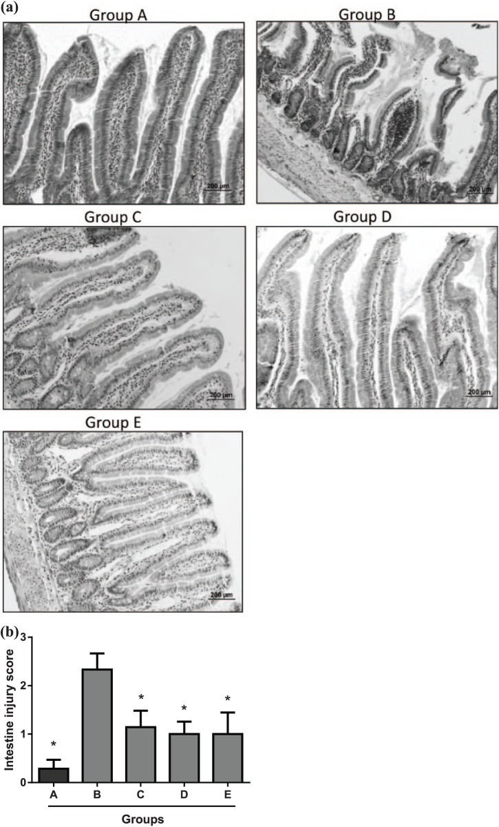 Remote post-conditioning and allopurinol reduce ischemia-reperfusion injury in an infra-renal ischemia model.