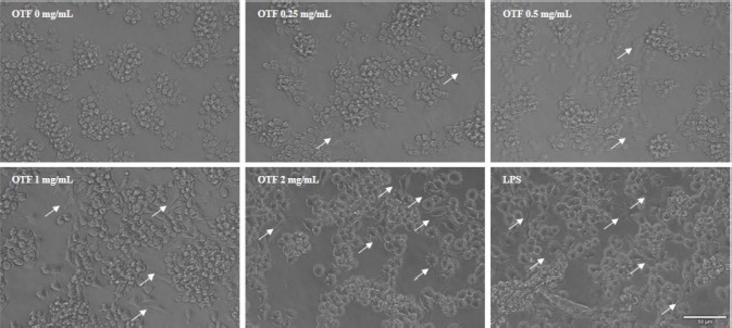 <i>In Vitro</i> Immune-Enhancing Activity of Ovotransferrin from Egg White via MAPK Signaling Pathways in RAW 264.7 Macrophages.