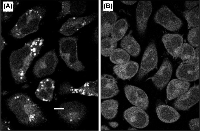 Label-free imaging of neurotransmitters in live brain tissue by multi-photon ultraviolet microscopy.