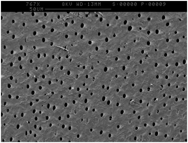 An <i>in vitro</i> model to assess effects of a desensitising agent on bacterial biofilm formation.