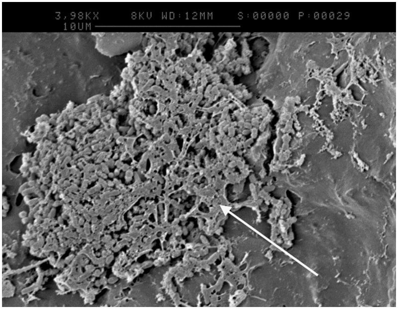 An <i>in vitro</i> model to assess effects of a desensitising agent on bacterial biofilm formation.