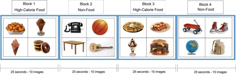 Brain activation to high-calorie food images in healthy normal weight and obese children: a fMRI study.