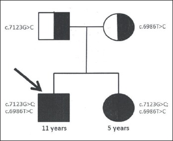 Novel desmoplakin mutations in familial Carvajal syndrome.